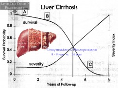 Liver Transplantation  How to Start A New Program