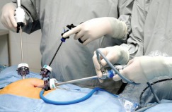 Larparoscopic liver resection - ten years experience in one center - University medical center Ho Chi Minh Vietnam