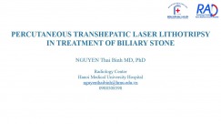 Percutaneous transhepatic laser lithotripsy In treatment of biliary stone