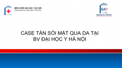 Báo cáo về Tán sỏi túi mật qua da một thì: Tại sao, Khi nào, Như thế nào?