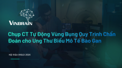 Chụp CT Tự Động Vùng Bụng Quy Trình Chẩn Đoán cho Ung Thư Biểu Mô Tế Bào Gan