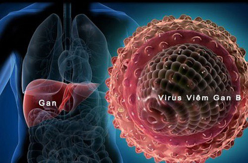 Viêm gan siêu vi và cách phòng bệnh