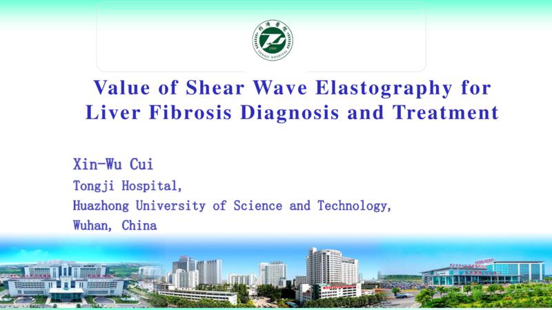 Value of Shear Wave Elastography for Liver Fibrosis Diagnosis and Treatment