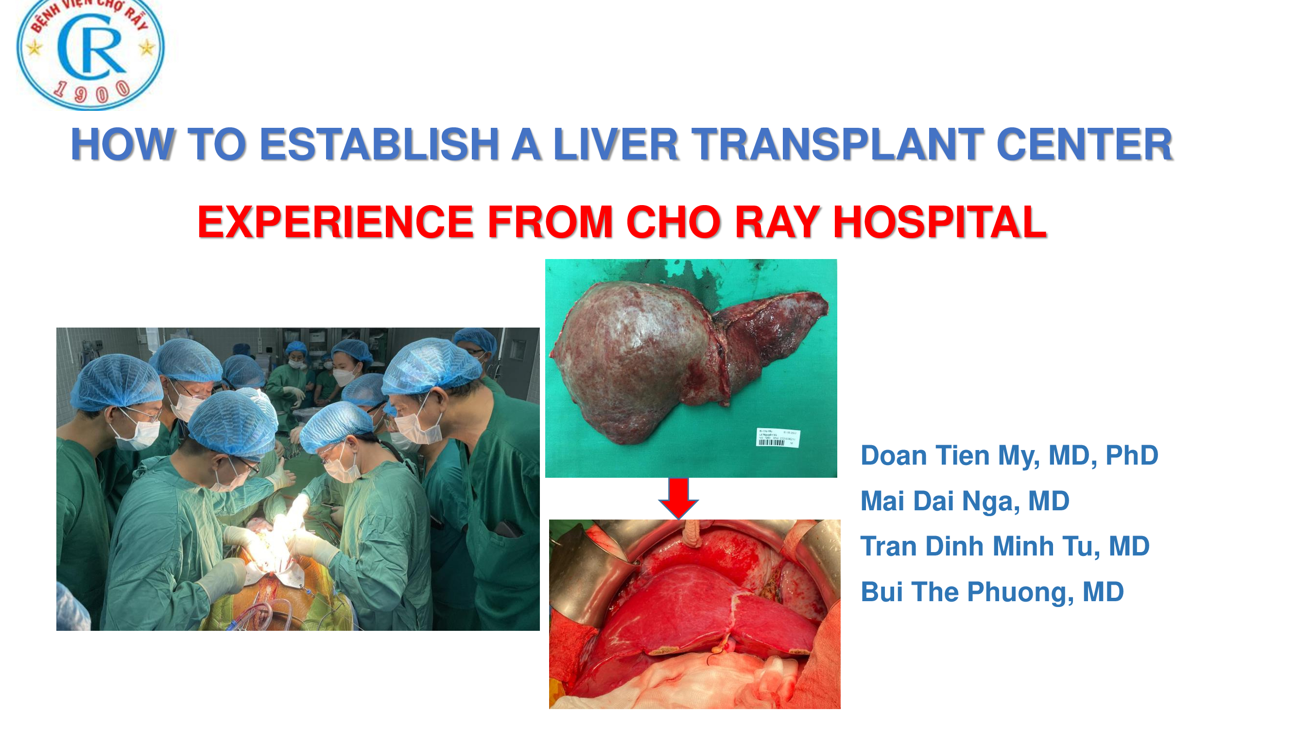How to establish a liver transplant center experience from Cho Ray hospital