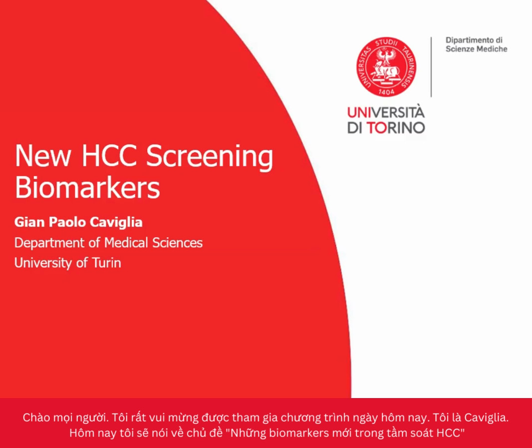 New HCC Screening Biomarkers Dr.Caviglia